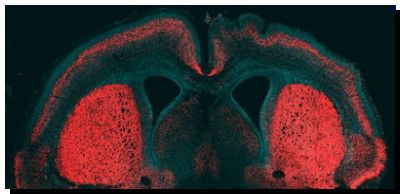 SALUD: Hallado un gen clave en la evolución de la mente