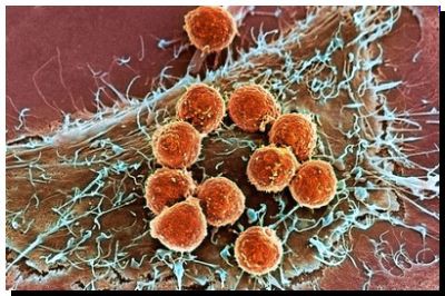 SALUD: El futuro contra el cáncer