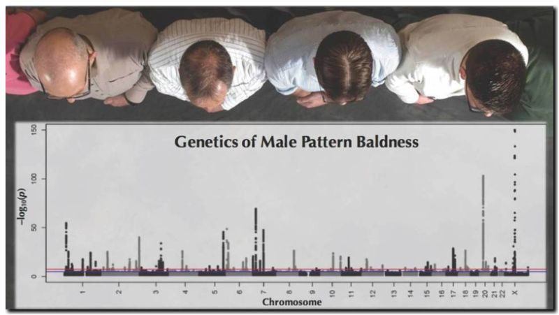 SALUD: Descubiertos los 287 genes que provocan la calvicie