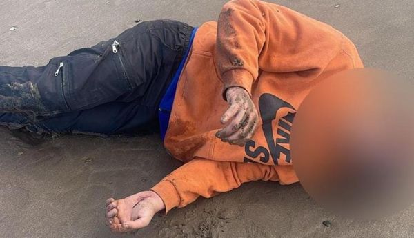 BALEADO: Hombre con antecedentes